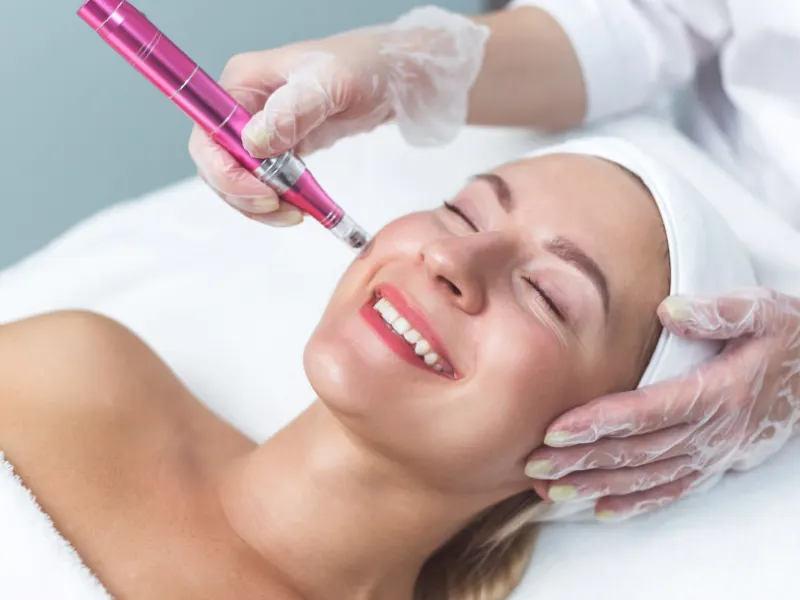 Micro Derma Facial candidates